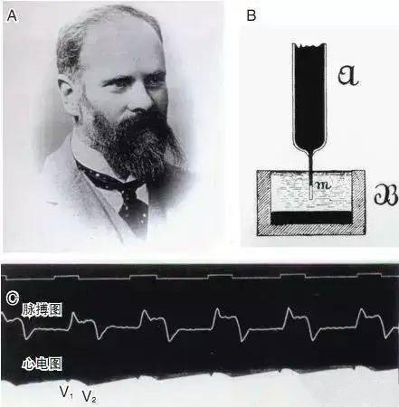 Waller及人类首例心电图